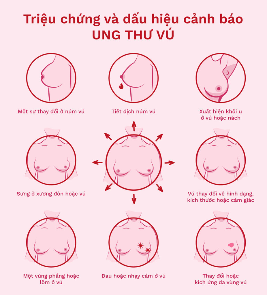 Dấu hiệu ung thư vú