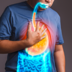 Nguyên nhân trào ngược dạ dày thực quản và yếu tố nguy cơ