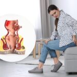 Tìm hiểu về trĩ - 