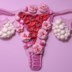 Hội chứng buồng trứng đa nang (PCOS): Thủ phạm khiến nữ giới khó thụ thai