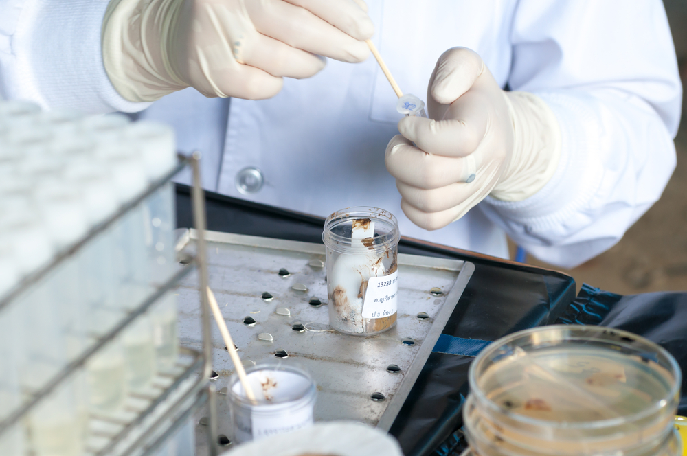 Phương pháp chẩn đoán trĩ nội