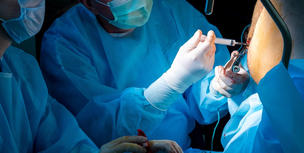 Phương pháp điều trị trĩ