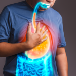 Trào ngược dạ dày thực quản có nguy hiểm không?