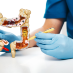 Bạn đã hiểu rõ về bệnh ung thư đại tràng?