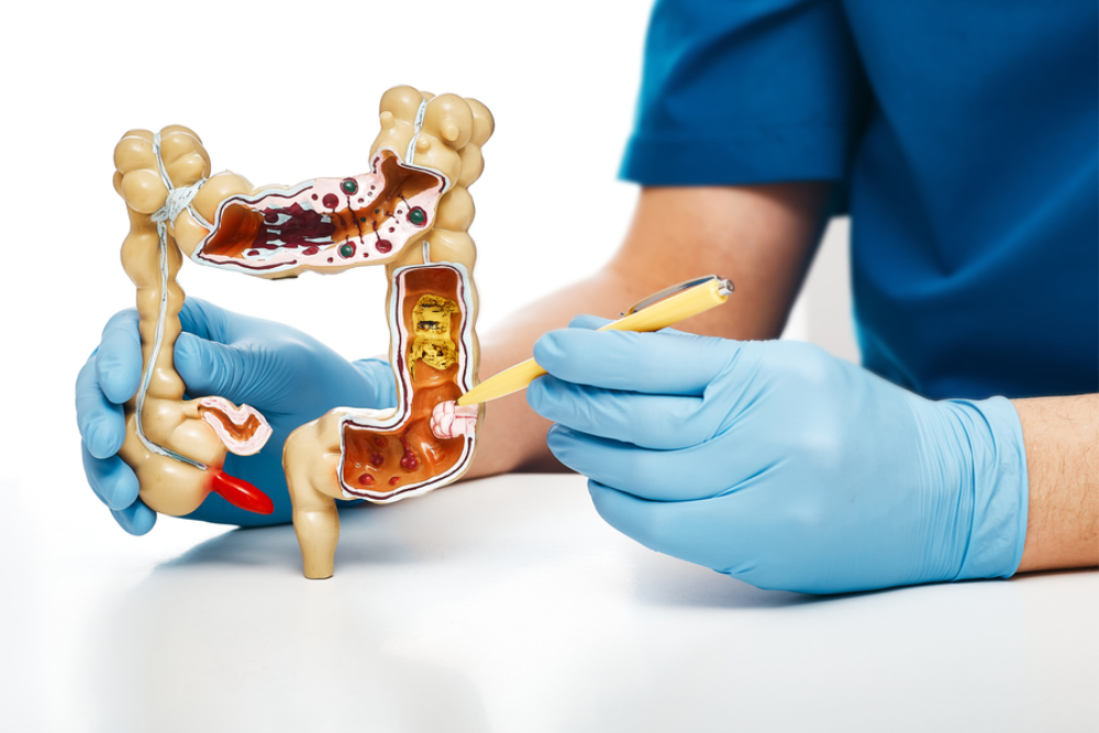 Bạn đã hiểu rõ về bệnh ung thư đại tràng?