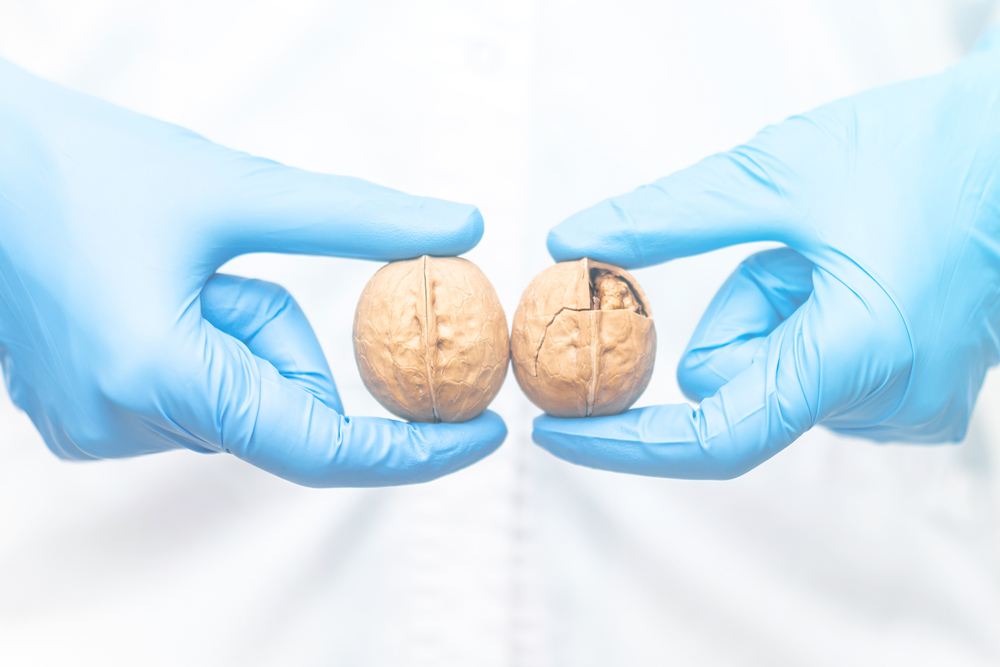 Cách kiểm tra ung thư tinh hoàn tại nhà