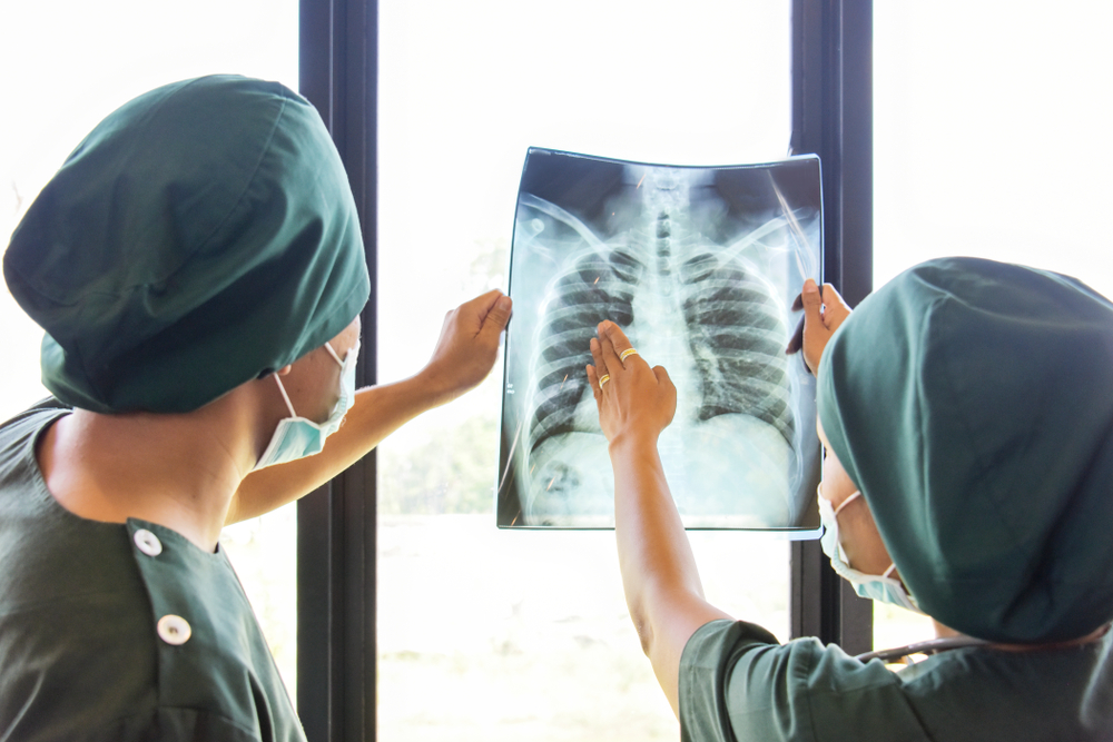 Phương pháp chẩn đoán lao phổi