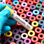 Nguyên nhân rối loạn lipid máu và cách phòng ngừa