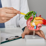 Những điều cần biết về sỏi mật