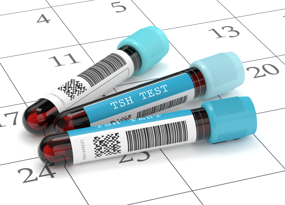 Phương pháp chẩn đoán suy giáp