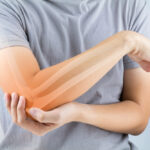 Các dấu hiệu ung thư xương thường gặp