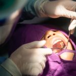 Khi nhổ răng khôn bảo hiểm y tế có chi trả không?