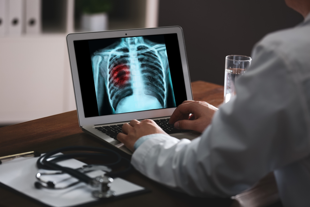 Dấu hiệu ung thư vòm họng tái phát