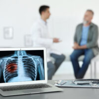 Điểm danh 8 phương pháp điều trị ung thư phổi mới nhất năm 2023