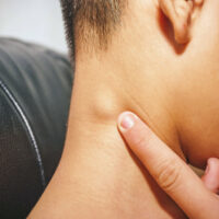 Đau họng nổi hạch có nguy hiểm không? Nguyên nhân và cách xử lý