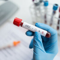 HIV có gây đau họng không? Đau họng do HIV kéo dài bao lâu?