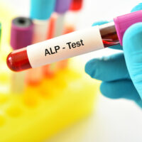 Mức alkaline phosphatase (ALP) có ý nghĩa gì? Cách giảm mức ALP