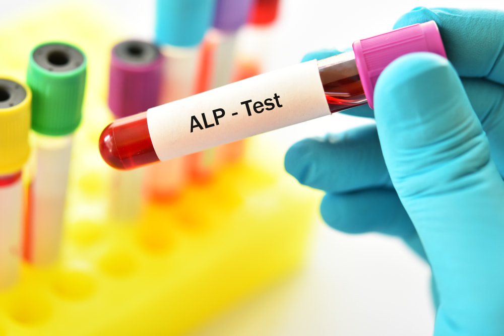 Mức alkaline phosphatase (ALP) có ý nghĩa gì? Cách giảm mức ALP