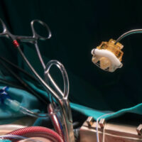 Nên mổ thay van tim ở bệnh viện nào tốt? Xem ngay 10 địa chỉ dưới đây