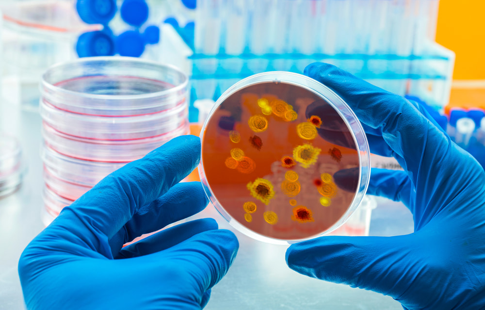 Hình ảnh các chủng virus sốt xuất huyết