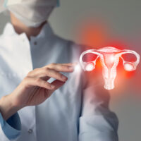 Ung thư cổ tử cung giai đoạn III (giai đoạn 3): Làm gì để ngăn bệnh tiến triển?